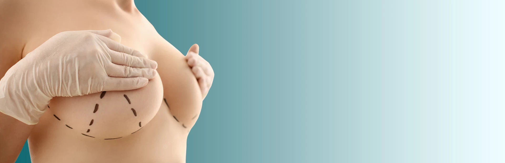 شد الصدر: استعادة الجمال والثقة بالنفس