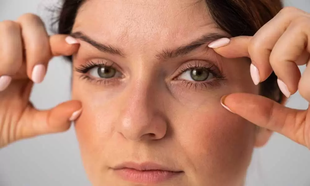 عملية شد الجفون بالصور