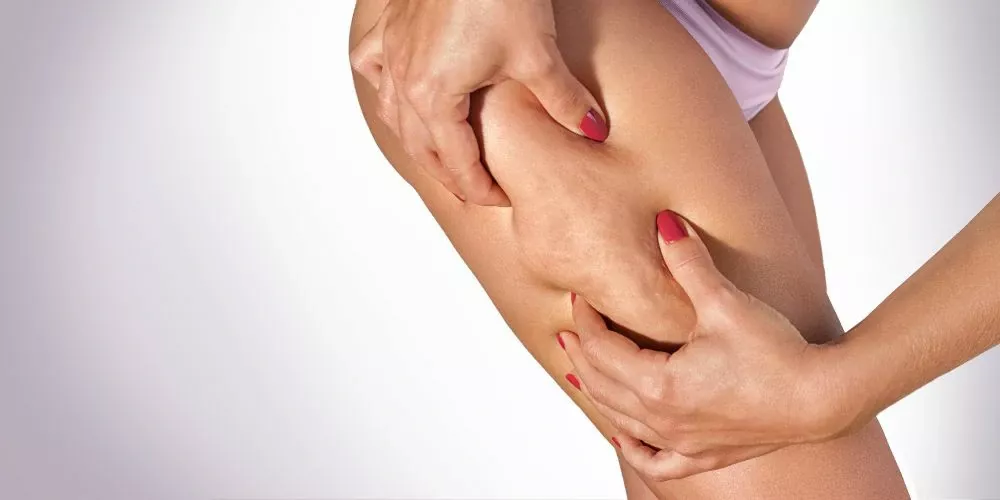 عملية شد الأفخاذ بالليزر: الحل المثالي لاستعادة شباب وجمال ساقيك