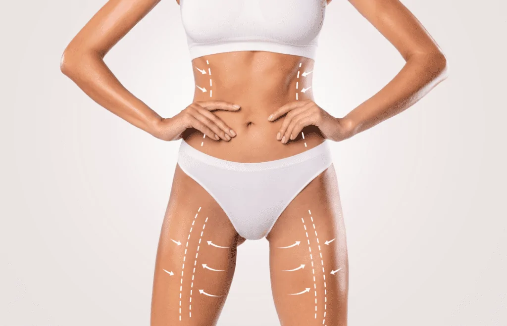 رحلة شد الجسم بعد التخسيس: دليل كامل للحصول على قوام مشدود